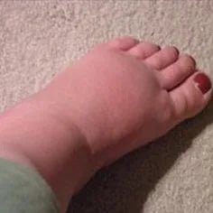 How to Stop the Bloating of Water Retention - Elektra Magnesium