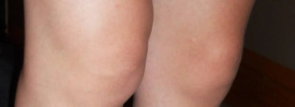 Magnesium Soothes Pain and Inflammation - Elektra Magnesium