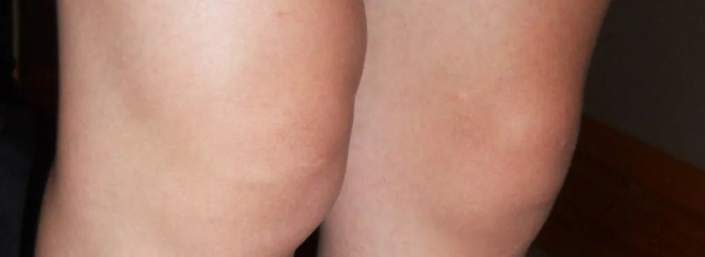 Magnesium Soothes Pain and Inflammation