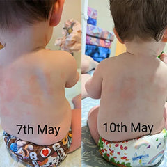 Babycare and Sensitivity Bundle